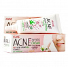 ACNE Spots Cream, ISME (Крем для проблемной кожи, ИСМЕ), 10 г.
